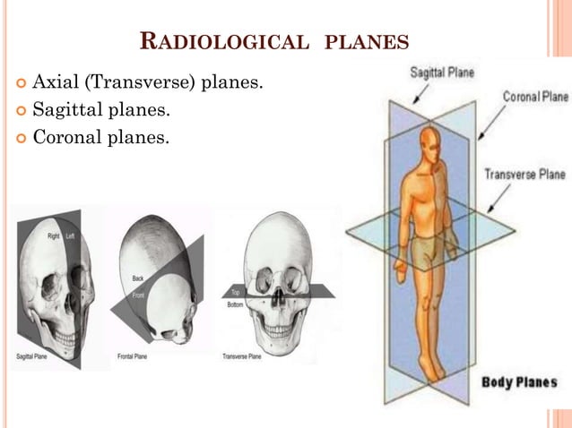 Basic about radiology & imaging.pdf