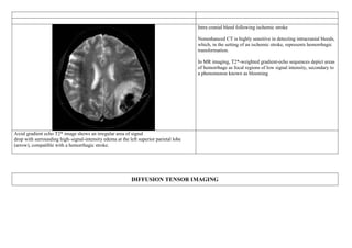 Intra cranial bleed following ischemic stroke
Nonenhanced CT is highly sensitive in detecting intracranial bleeds,
which, in the setting of an ischemic stroke, represents hemorrhagic
transformation.
In MR imaging, T2*-weighted gradient-echo sequences depict areas
of hemorrhage as focal regions of low signal intensity, secondary to
a phenomenon known as blooming
Axial gradient echo T2* image shows an irregular area of signal
drop with surrounding high–signal-intensity edema at the left superior parietal lobe
(arrow), compatible with a hemorrhagic stroke.
DIFFUSION TENSOR IMAGING
 