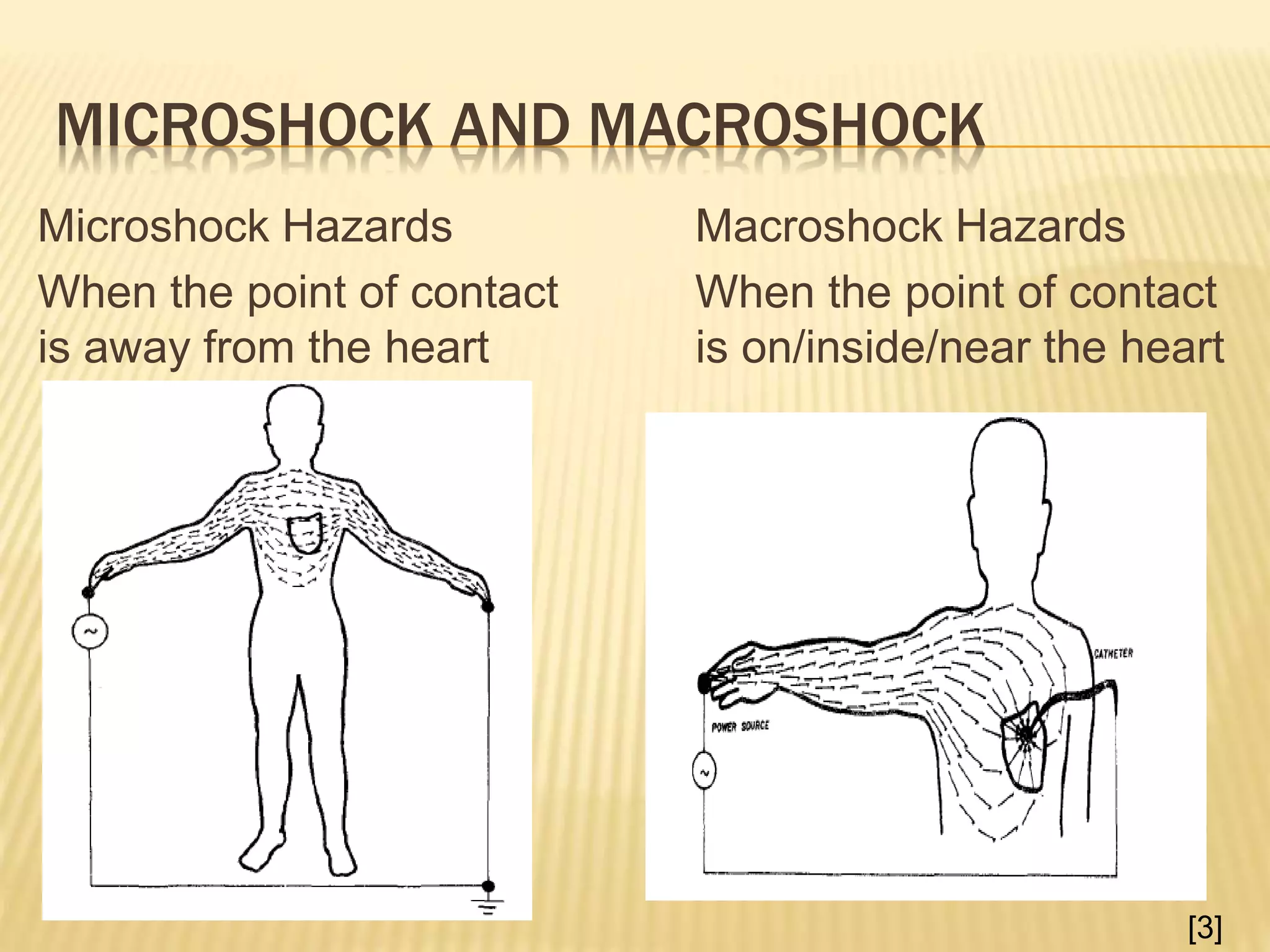 MICROSHOCK AND MACROSHOCK
Macroshock Hazards
When the point of contact
is on/inside/near the heart
Microshock Hazards
When the point of contact
is away from the heart
[3]
 