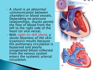  A shunt is an abnormal
communication between
chambers or blood vessels.
Depending on pressure
relationships, shunts permit
the flow of blood from the
left to the right side of the
heart (or vice versa).
 With right-to-left shunt, a
dusky blueness of the skin
(cyanosis) results because
the pulmonary circulation is
bypassed and poorly
oxygenated blood collected
from the venous system
enters the systemic arterial
circulation.
 