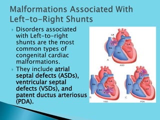  Disorders associated
with Left-to-right
shunts are the most
common types of
congenital cardiac
malformations.
 They include atrial
septal defects (ASDs),
ventricular septal
defects (VSDs), and
patent ductus arteriosus
(PDA).
 