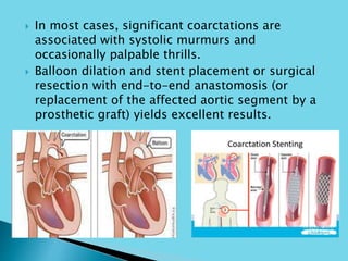  In most cases, significant coarctations are
associated with systolic murmurs and
occasionally palpable thrills.
 Balloon dilation and stent placement or surgical
resection with end-to-end anastomosis (or
replacement of the affected aortic segment by a
prosthetic graft) yields excellent results.
 