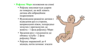 • Рефлекс Моро положення на спині
• Рефлекс викликається ударом
по поверхні, на якій лежить
дитина або вібраційним
подразником
• Відповідною реакцією дитини є
відведення рук в сторони,
випрямлення ніжок, попередньо
зігнутих і притиснутих до
живота - 1 фаза рефлексу Моро
• Зведення рук з тенденцією до
обхвату тулуба - 2 фаза
рефлексу Моро
• Рефлекс виражений до 4
місяців, потім починає згасати
 