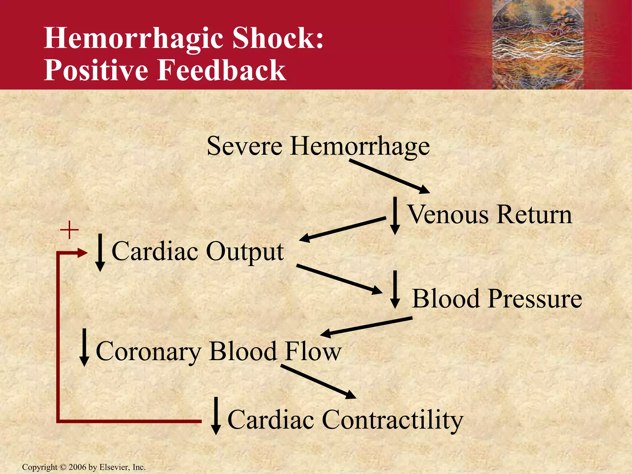 Copyright © 2006 by Elsevier, Inc.
Hemorrhagic Shock:
Positive Feedback
Severe Hemorrhage
Venous Return
Cardiac Output
Blood Pressure
Coronary Blood Flow
Cardiac Contractility
+
 