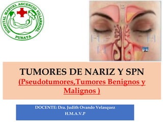 DOCENTE: Dra. Judith Ovando Velasquez
H.M.A.V.P
TUMORES DE NARIZ Y SPN
(Pseudotumores,Tumores Benignos y
Malignos )
 