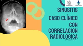 SINUSITIS
Caso clínico
con
correlacion
radiologica
IMAGENOLOGÍA
 