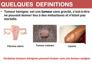 QUELQUES DEFINITIONS
• Tumeur bénigne: est une tumeur sans gravité, c'est-à-dire
ne pouvant donner lieu à des métastases et n'étant pas
mortelle.
Fibrome utérin Tumeur cutanée Lipome
Certaines tumeurs bénignes peuvent évoluer vers une tumeur maligne
 