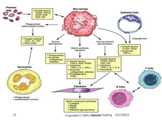 3/31/2023
wound healing
13
 