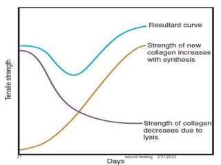 3/31/2023
wound healing
21
 