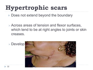 Hypertrophic scars
 Does not extend beyond the boundary
 Across areas of tension and flexor surfaces,
which tend to be at right angles to joints or skin
creases.
 Develop within 4 weeks after trauma.
3/31/2023
wound healing
32
 