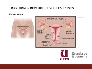 1.1 CANCER DE MAMA Y CERVICAL.pptx