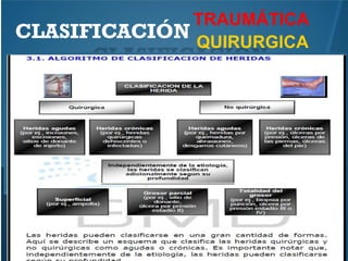 CLASIFICACIÓN
TRAUMÁTICA
QUIRURGICA
 