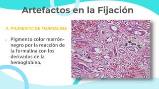 Artefactos en la Fijación
A. PIGMENTO DE FORMALINA
• Pigmento color marrón-
negro por la reacción de
la formalina con los
derivados de la
hemoglobina.
 