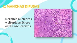 C. MANCHAS DIFUSAS
• Detalles nucleares
y citoplasmáticos
están oscurecidos
 