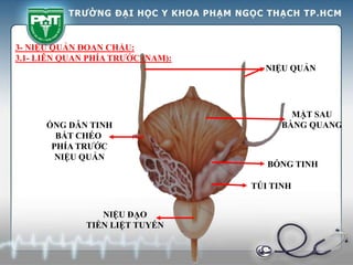 MẶT SAU
BÀNG QUANG
NIỆU QUẢN
NIỆU ĐẠO
TIỀN LIỆT TUYẾN
BÓNG TINH
TÚI TINH
3- NIỆU QUẢN ĐOẠN CHẬU:
3.1- LIÊN QUAN PHÍA TRƯỚC (NAM):
ỐNG DẪN TINH
BẮT CHÉO
PHÍA TRƯỚC
NIỆU QUẢN
 
