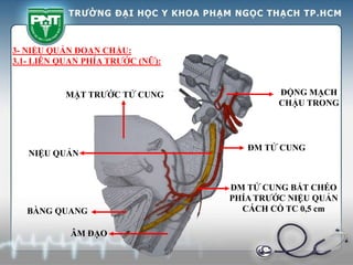 ÂM ĐẠO
MẶT TRƯỚC TỬ CUNG ĐỘNG MẠCH
CHẬU TRONG
NIỆU QUẢN
ĐM TỬ CUNG
ĐM TỬ CUNG BẮT CHÉO
PHÍA TRƯỚC NIỆU QUẢN
CÁCH CỔ TC 0,5 cm
BÀNG QUANG
3- NIỆU QUẢN ĐOẠN CHẬU:
3.1- LIÊN QUAN PHÍA TRƯỚC (NỮ):
 