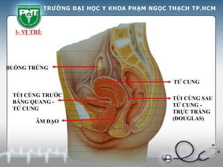 1- VỊ TRÍ:
BUỒNG TRỨNG
TỬ CUNG
ÂM ĐẠO
TÚI CÙNG TRƯỚC
BÀNG QUANG -
TỬ CUNG
TÚI CÙNG SAU
TỬ CUNG -
TRỰC TRÀNG
(DOUGLAS)
 
