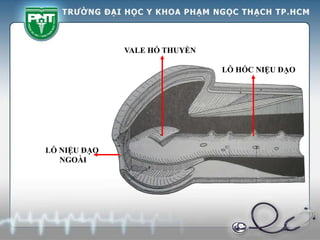 LỖ HỐC NIỆU ĐẠO
VALE HỐ THUYỀN
LỖ NIỆU ĐẠO
NGOÀI
 