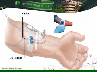 DISTRIBUCIÓN DE LÍQUIDOS
VENA
CATETER
14
UNIVERSIDAD
Popular del
Cesar
 
