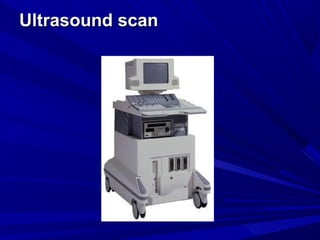 Ultrasound scan
Ultrasound scan
 