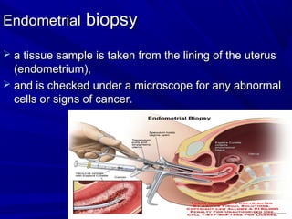 Endometrial
Endometrial biopsy
biopsy
 a tissue sample is taken from the lining of the uterus
a tissue sample is taken from the lining of the uterus
(endometrium(,
(endometrium(,
 and is checked under a microscope for any abnormal
and is checked under a microscope for any abnormal
cells or signs of cancer.
cells or signs of cancer.
 