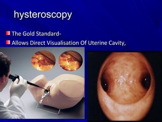 hysteroscopy
hysteroscopy
The Gold Standard-
The Gold Standard-
Allows Direct Visualisation Of Uterine Cavity,
Allows Direct Visualisation Of Uterine Cavity,
 