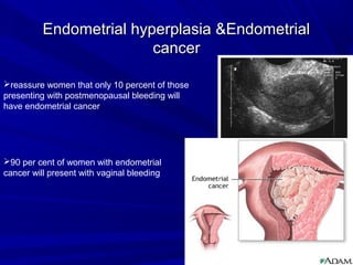 Endometrial hyperplasia &Endometrial
Endometrial hyperplasia &Endometrial
cancer
cancer
reassure women that only 10 percent of those
presenting with postmenopausal bleeding will
have endometrial cancer
90 per cent of women with endometrial
cancer will present with vaginal bleeding
 