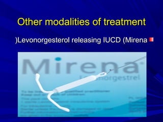 Other modalities of treatment
Other modalities of treatment
Levonorgesterol releasing IUCD (Mirena
Levonorgesterol releasing IUCD (Mirena
(
(
 