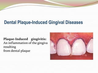 1.introduction to periodontics.pptx