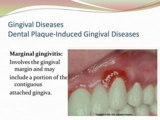 1.introduction to periodontics.pptx
