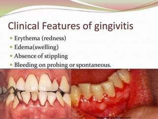 1.introduction to periodontics.pptx