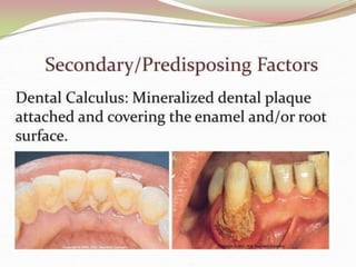 1.introduction to periodontics.pptx