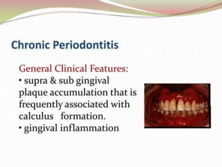 1.introduction to periodontics.pptx