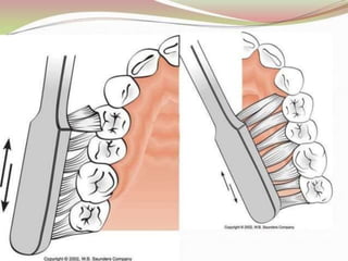 1.introduction to periodontics.pptx
