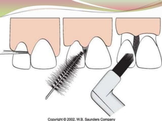 1.introduction to periodontics.pptx