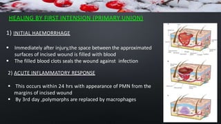HEALING BY FIRST INTENSION (PRIMARY UNION)
1) INITIAL HAEMORRHAGE
 Immediately after injury,the space between the approximated
surfaces of incised wound is filled with blood
 The filled blood clots seals the wound against infection
2) ACUTE INFLAMMATORY RESPONSE
 This occurs within 24 hrs with appearance of PMN from the
margins of incised wound
 By 3rd day ,polymorphs are replaced by macrophages
 