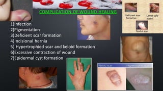 COMPLICATION OF WOUND HEALING
1)Infection
2)Pigmentation
3)Deficient scar formation
4)Incisional hernia
5) Hypertrophied scar and keloid formation
6)Excessive contraction of wound
7)Epidermal cyst formation
 