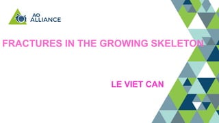 FRACTURES IN THE GROWING SKELETON
LE VIET CAN
 