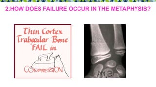 2.HOW DOES FAILURE OCCUR IN THE METAPHYSIS?
 