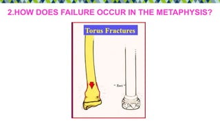 2.HOW DOES FAILURE OCCUR IN THE METAPHYSIS?
 