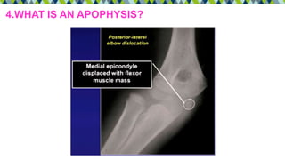 4.WHAT IS AN APOPHYSIS?
 