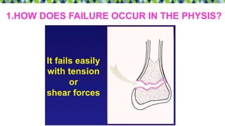 1.HOW DOES FAILURE OCCUR IN THE PHYSIS?
 