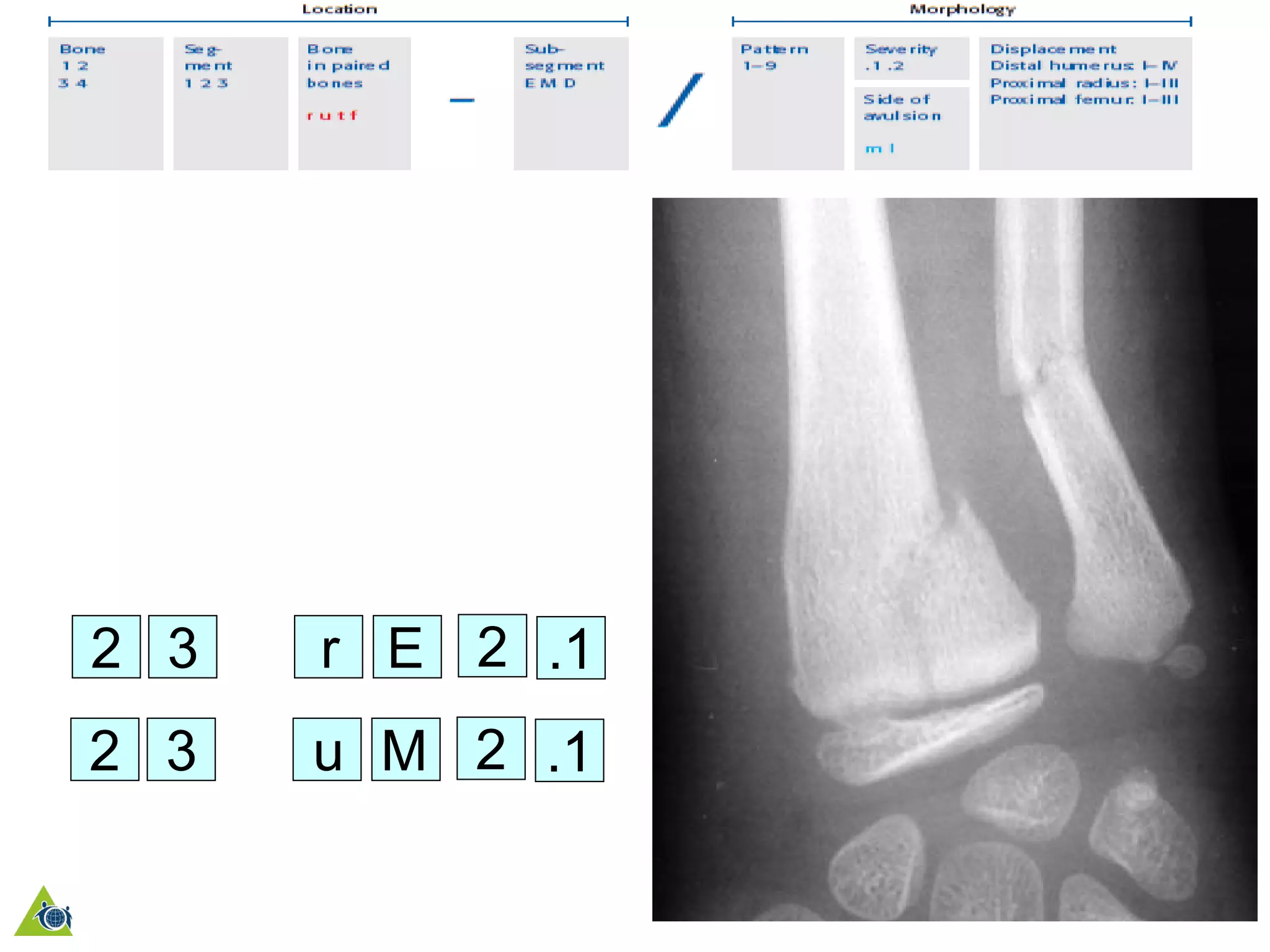1.3-AO pediatric comprehensive classification VNM.pdf