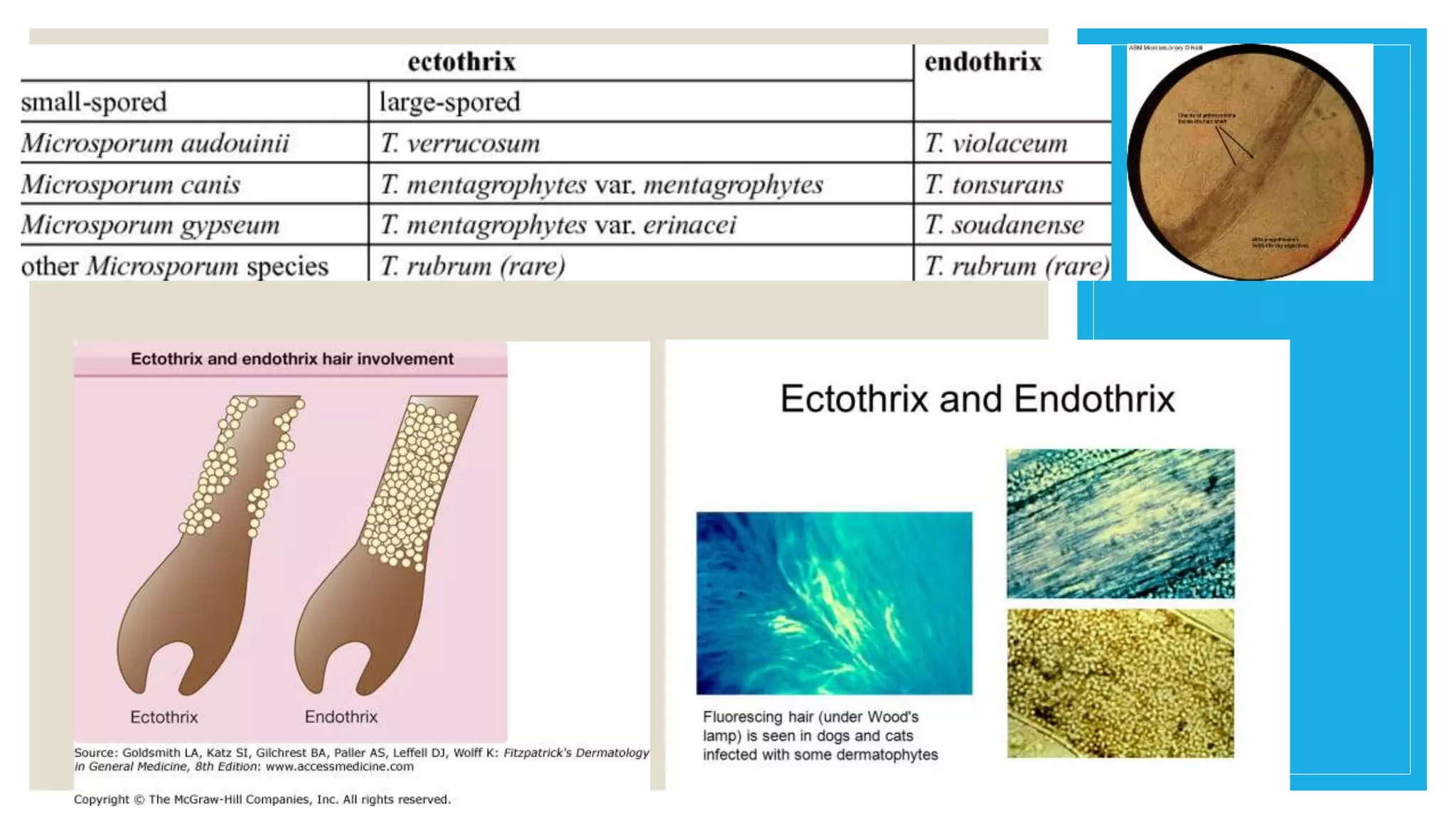 1. Dermatofitosis (1).pptx