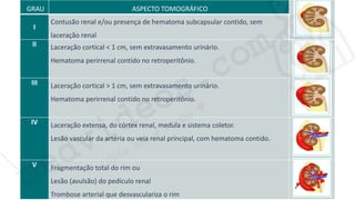 medvideos.com
Cópia não é roubo ♥
GRAU ASPECTO TOMOGRÁFICO
I
Contusão renal e/ou presença de hematoma subcapsular contido, sem
laceração renal
II Laceração cortical < 1 cm, sem extravasamento urinário.
Hematoma perirrenal contido no retroperitônio.
III Laceração cortical > 1 cm, sem extravasamento urinário.
Hematoma perirrenal contido no retroperitônio.
IV Laceração extensa, do córtex renal, medula e sistema coletor.
Lesão vascular da artéria ou veia renal principal, com hematoma contido.
V Fragmentação total do rim ou
Lesão (avulsão) do pedículo renal
Trombose arterial que desvasculariza o rim
medvideos.com
Cópia não é roubo ♥
 