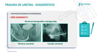 medvideos.com
Cópia não é roubo ♥
Renatha Paiva
TRAUMA DE URETRA - DIAGNÓSTICO
• URETROCISTOGRAFIA RETRÓGRADA
• NÃO SONDAR!!!!
medvideos.com
Cópia não é roubo ♥
 