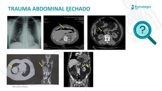 medvideos.com
Cópia não é roubo ♥
TRAUMA ABDOMINAL FECHADO
Renatha Paiva
medvideos.com
Cópia não é roubo ♥
 