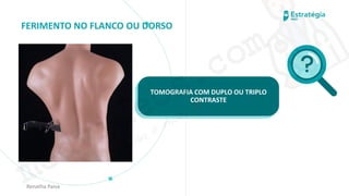 medvideos.com
Cópia não é roubo ♥
FERIMENTO NO FLANCO OU DORSO
Renatha Paiva
TOMOGRAFIA COM DUPLO OU TRIPLO
CONTRASTE
medvideos.com
Cópia não é roubo ♥
 