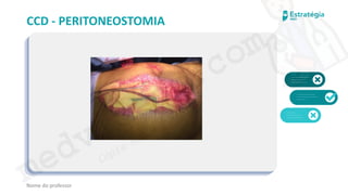 medvideos.com
Cópia não é roubo ♥
CCD - PERITONEOSTOMIA
Nome do professor
medvideos.com
Cópia não é roubo ♥
 