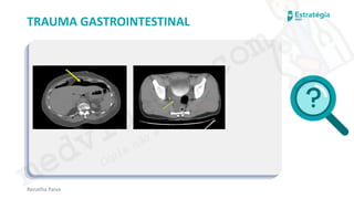 medvideos.com
Cópia não é roubo ♥
Renatha Paiva
TRAUMA GASTROINTESTINAL
medvideos.com
Cópia não é roubo ♥
 